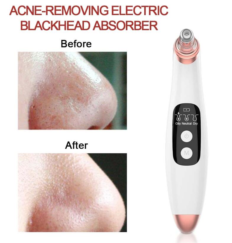 USB Electri Vacuum Suction Blackhead Remover  LED Display Visual Pore Pimple Deep